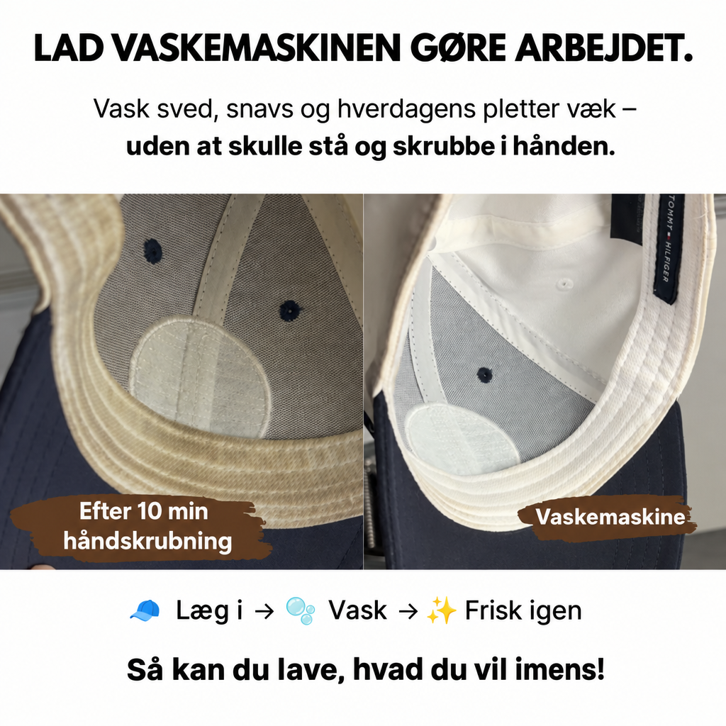 Kasketvaskeren